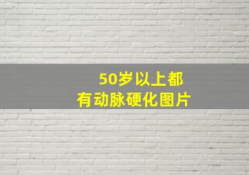 50岁以上都有动脉硬化图片