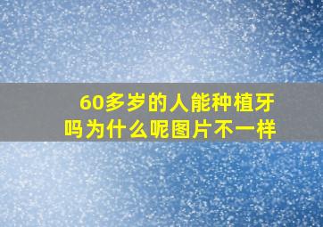 60多岁的人能种植牙吗为什么呢图片不一样