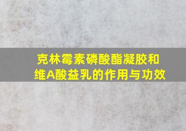 克林霉素磷酸酯凝胶和维A酸益乳的作用与功效