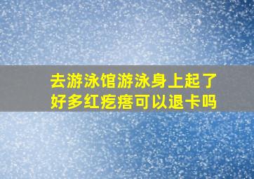 去游泳馆游泳身上起了好多红疙瘩可以退卡吗