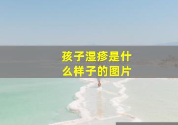 孩子湿疹是什么样子的图片