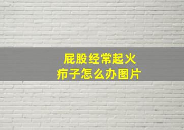 屁股经常起火疖子怎么办图片