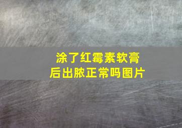 涂了红霉素软膏后出脓正常吗图片