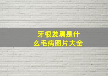 牙根发黑是什么毛病图片大全