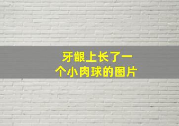 牙龈上长了一个小肉球的图片