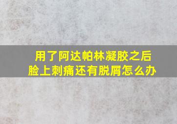 用了阿达帕林凝胶之后脸上刺痛还有脱屑怎么办