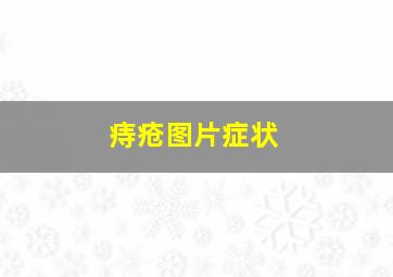 痔疮图片症状