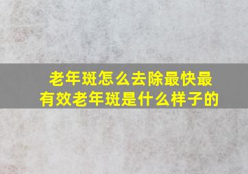 老年斑怎么去除最快最有效老年斑是什么样子的