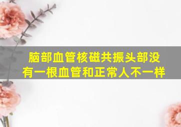 脑部血管核磁共振头部没有一根血管和正常人不一样