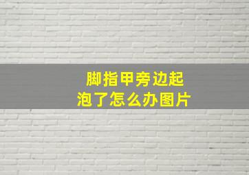 脚指甲旁边起泡了怎么办图片