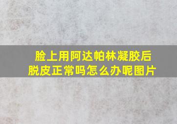 脸上用阿达帕林凝胶后脱皮正常吗怎么办呢图片