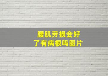 腰肌劳损会好了有病根吗图片